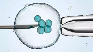 What to Know Before an Embryo Transfer