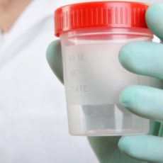 Sperm Test Analysis and Treatment Options?