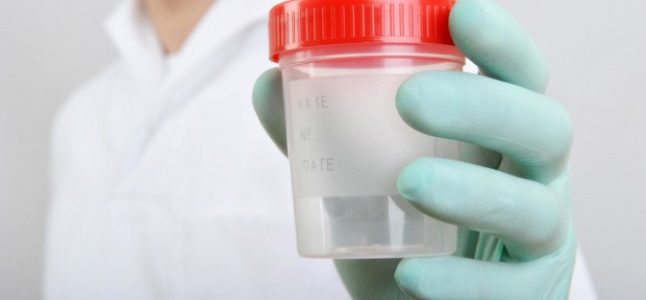 Sperm Test Analysis and Treatment Options?