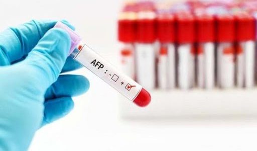 Alpha-Fetoprotein (AFP) Test