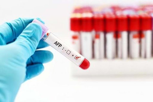 Alpha-Fetoprotein (AFP) Test