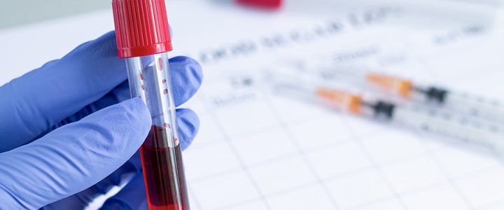 Blood Type Incompatibility Test