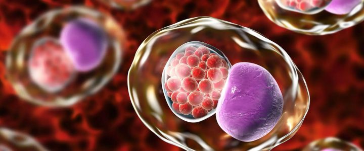 Chlamydia and Infertility